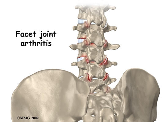 Facet Bone